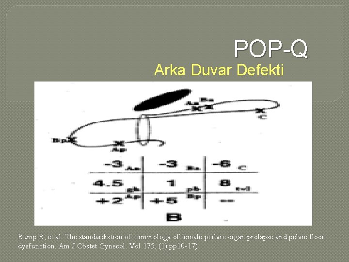 POP-Q Arka Duvar Defekti Bump R, et al. The standardiztion of terminology of female
