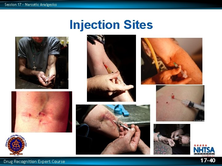 Session 17 – Narcotic Analgesics Injection Sites Drug Recognition Expert Course 17 -40 