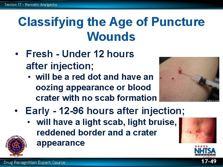 Session 17 – Narcotic Analgesics Classifying the Age of Puncture Wounds • Fresh -