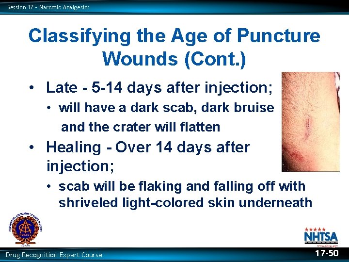 Session 17 – Narcotic Analgesics Classifying the Age of Puncture Wounds (Cont. ) •