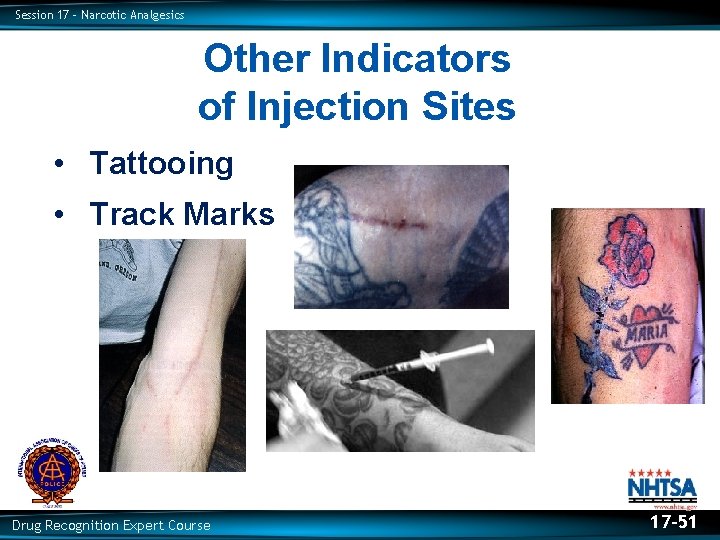 Session 17 – Narcotic Analgesics Other Indicators of Injection Sites • Tattooing • Track