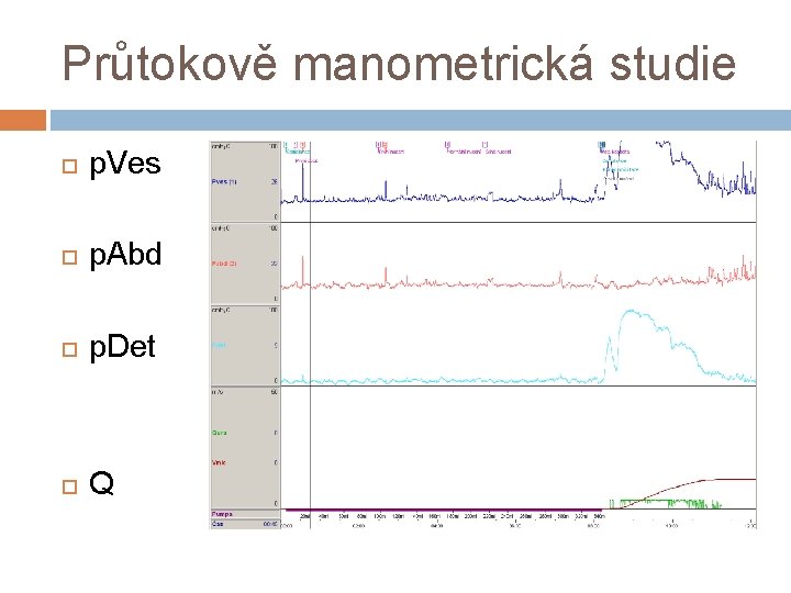 Průtokově manometrická studie p. Ves p. Abd p. Det Q 