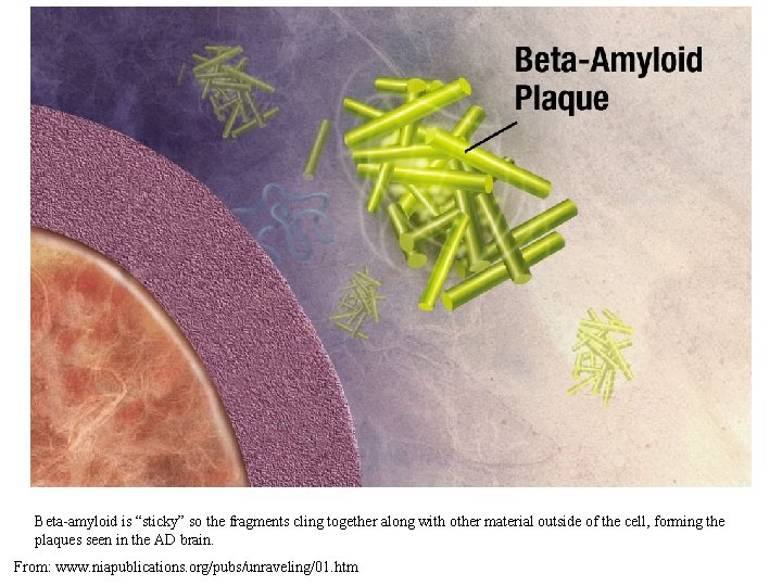 Beta-amyloid is “sticky” so the fragments cling together along with other material outside of