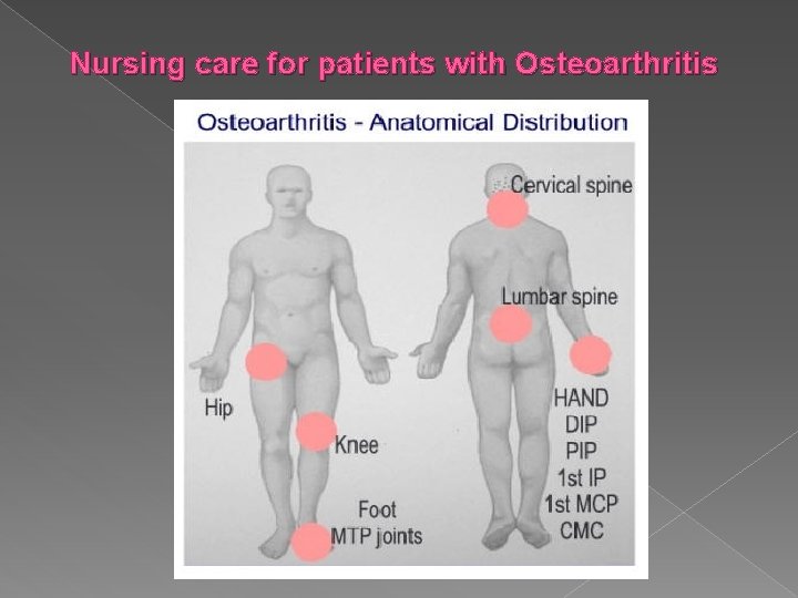 Nursing care for patients with Osteoarthritis 