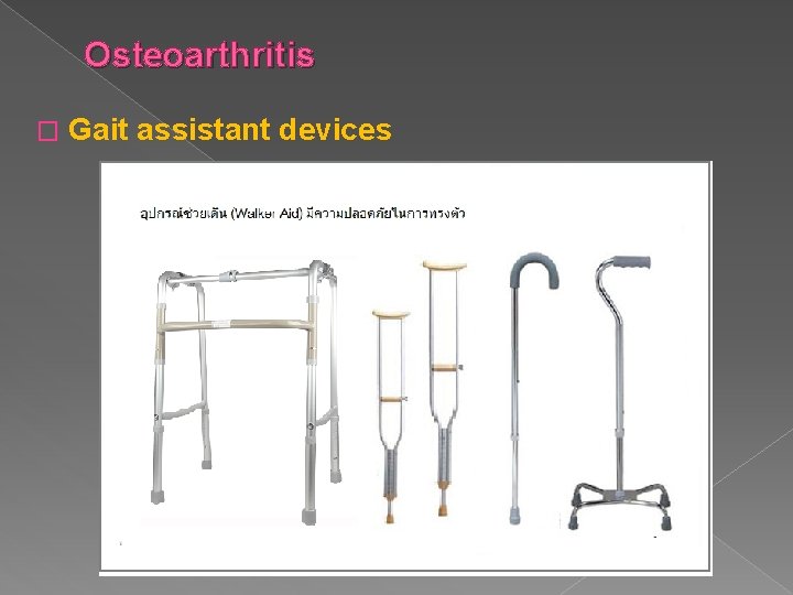 Osteoarthritis � Gait assistant devices 