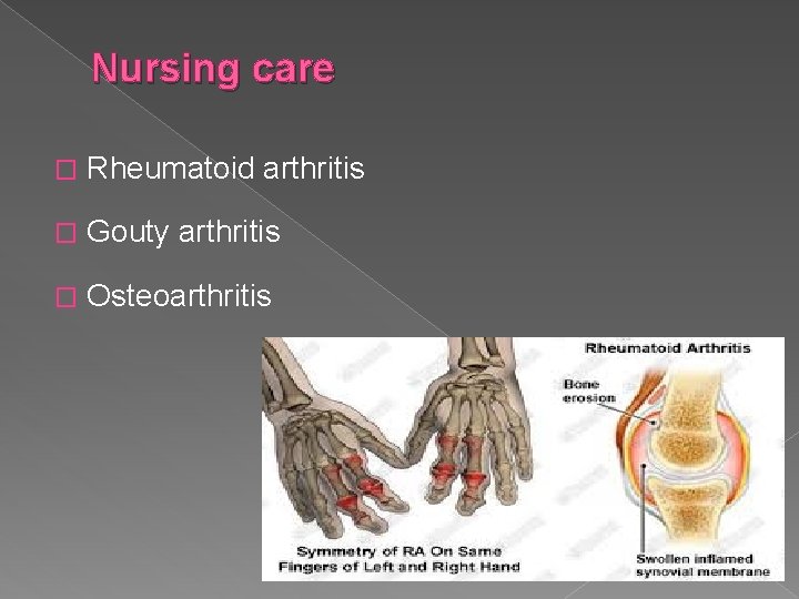 Nursing care � Rheumatoid arthritis � Gouty arthritis � Osteoarthritis 