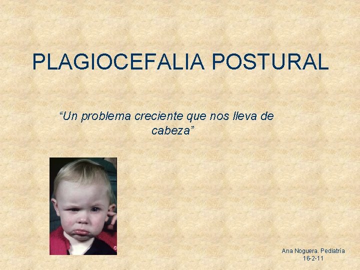PLAGIOCEFALIA POSTURAL “Un problema creciente que nos lleva de cabeza” Ana Noguera. Pediatría 16