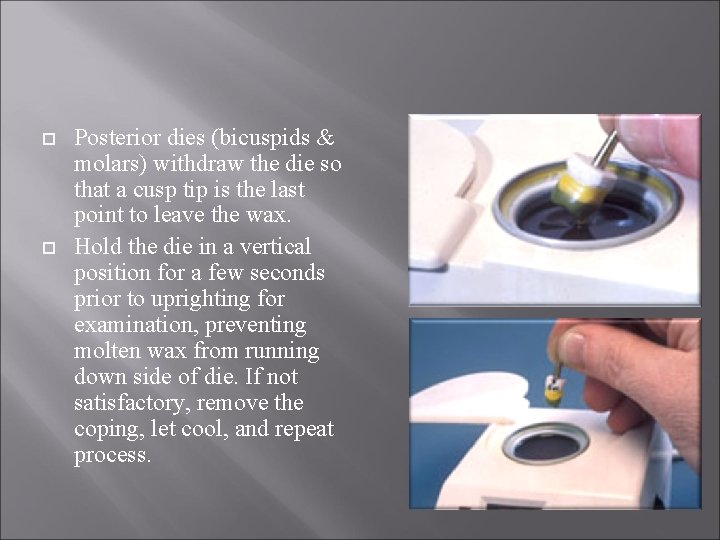  Posterior dies (bicuspids & molars) withdraw the die so that a cusp tip