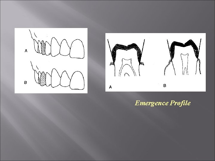 Emergence Profile 