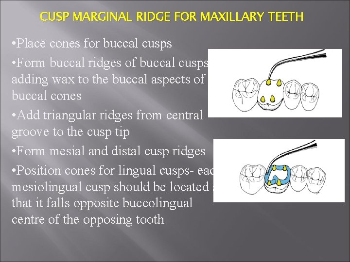 CUSP MARGINAL RIDGE FOR MAXILLARY TEETH • Place cones for buccal cusps • Form