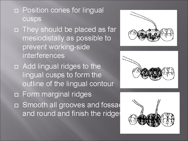  Position cones for lingual cusps They should be placed as far mesiodistally as