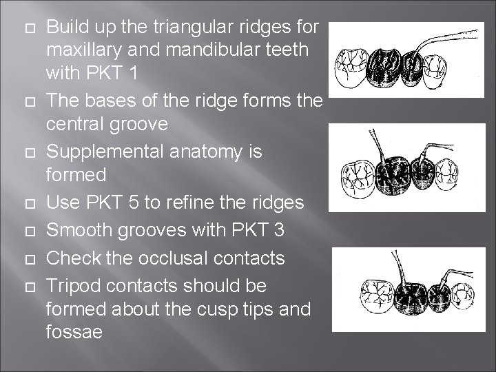  Build up the triangular ridges for maxillary and mandibular teeth with PKT 1