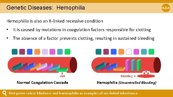 Genetic Diseases: Hemophilia is also an X-linked recessive condition • It is caused by Genetic Diseases: Hemophilia is also an X-linked recessive condition • It is caused by