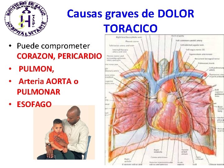 Causas graves de DOLOR TORACICO • Puede comprometer CORAZON, PERICARDIO • PULMON, • Arteria