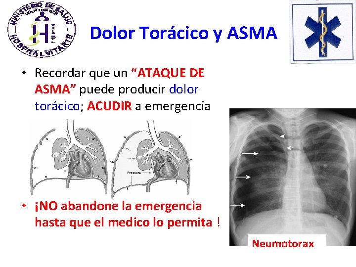 Dolor Torácico y ASMA • Recordar que un “ATAQUE DE ASMA” puede producir dolor