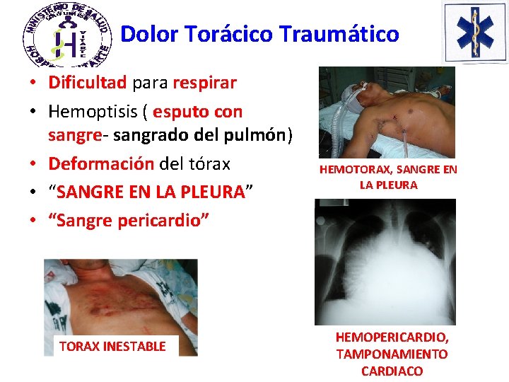 Dolor Torácico Traumático • Dificultad para respirar • Hemoptisis ( esputo con sangre- sangrado