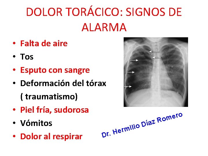 DOLOR TORÁCICO: SIGNOS DE ALARMA Falta de aire Tos Esputo con sangre Deformación del