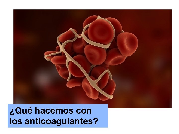 anticoagulantes ¿Qué hacemos con los anticoagulantes? 