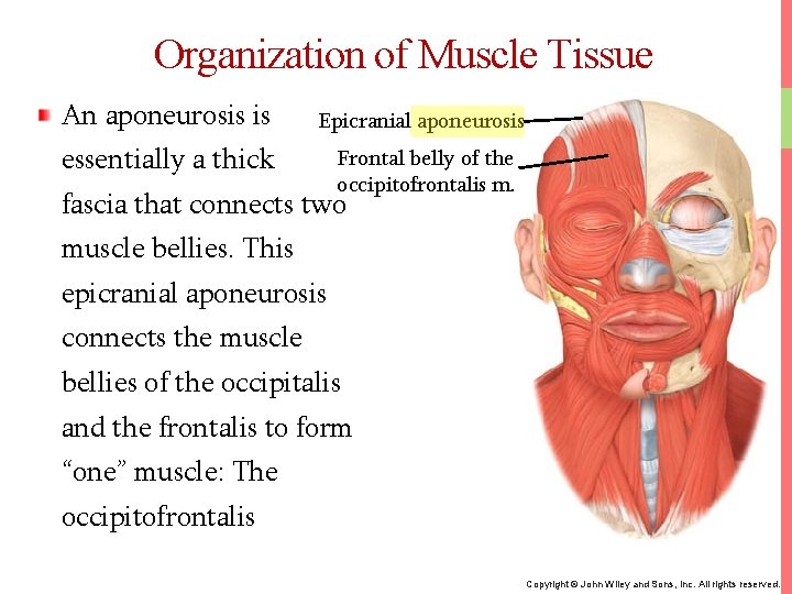 Organization of Muscle Tissue An aponeurosis is Epicranial aponeurosis essentially a thick Frontal belly