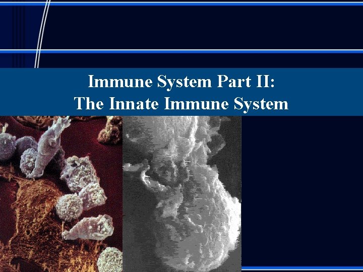 Immune System Part II: The Innate Immune System 