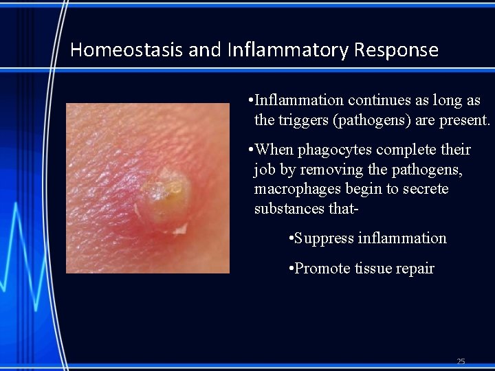 Homeostasis and Inflammatory Response • Inflammation continues as long as the triggers (pathogens) are