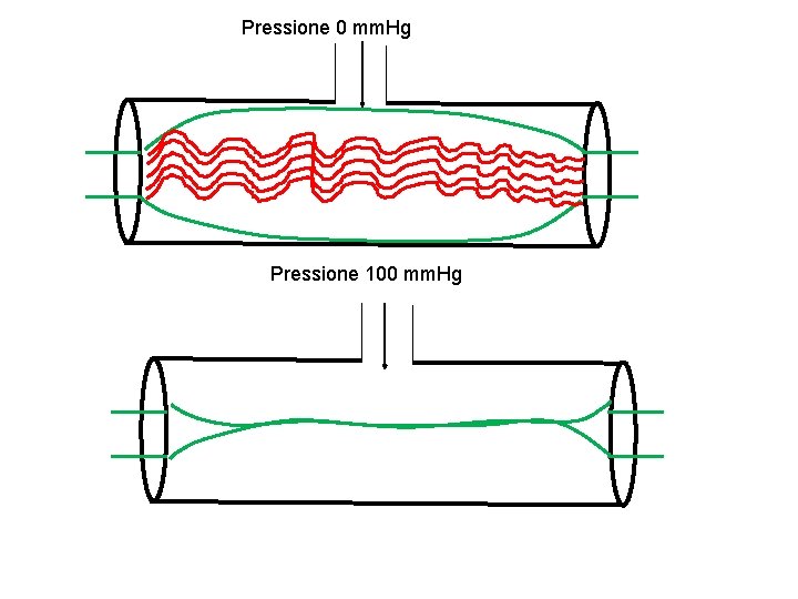 Pressione 0 mm. Hg Pressione 100 mm. Hg 