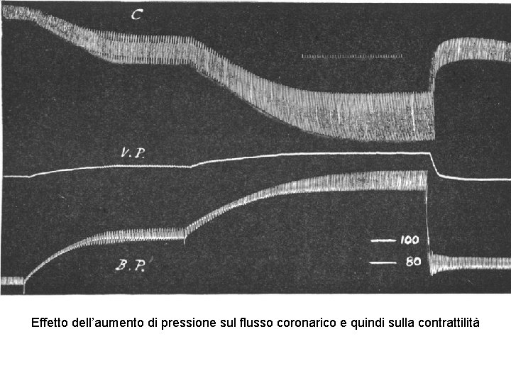 Effetto dell’aumento di pressione sul flusso coronarico e quindi sulla contrattilità 