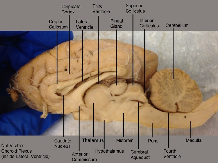 Thalamus 