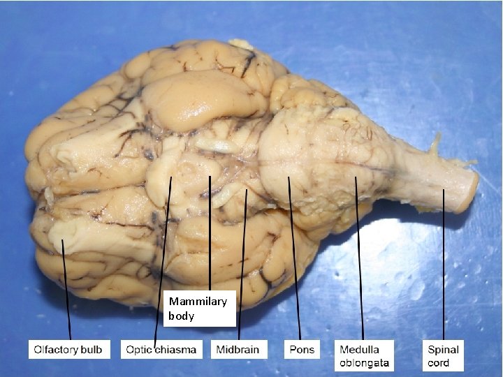 Mammilary body 