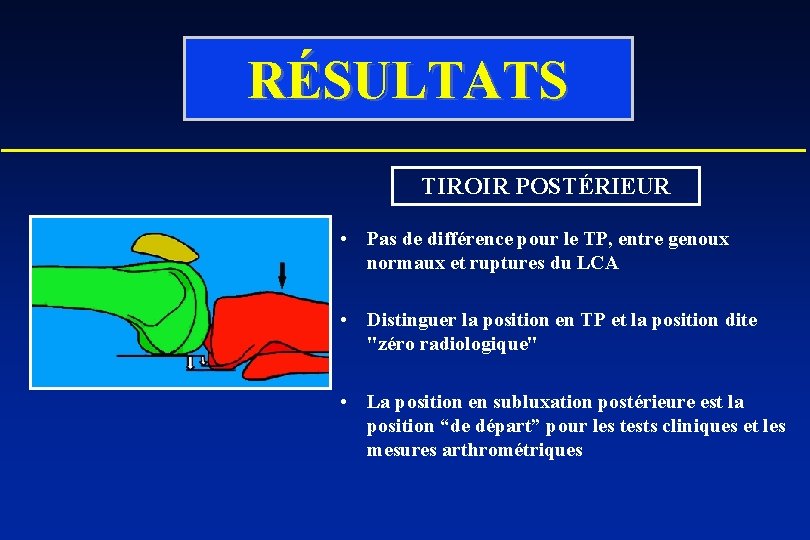 RÉSULTATS TIROIR POSTÉRIEUR • Pas de différence pour le TP, entre genoux normaux et