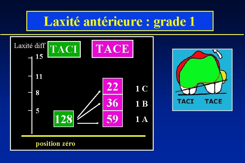 Laxité antérieure : grade 1 Laxité diff 15 TACI TACE 128 22 36 59