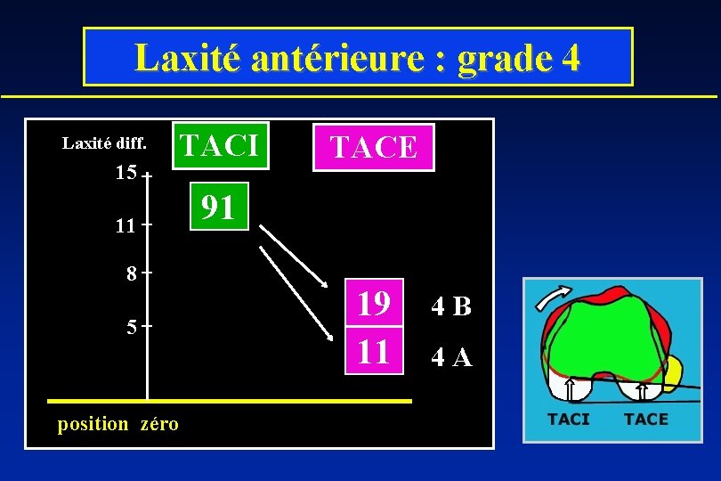 Laxité antérieure : grade 4 Laxité diff. 15 TACI 11 8 5 position zéro