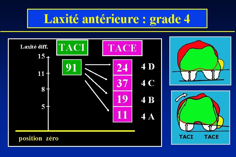 Laxité antérieure : grade 4 Laxité diff. 15 TACI TACE 91 24 37 19