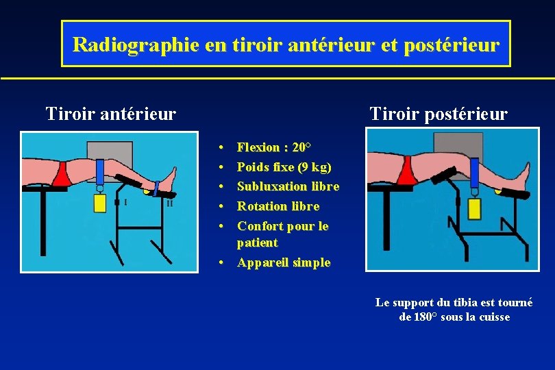 Radiographie en tiroir antérieur et postérieur Tiroir antérieur Tiroir postérieur • • • Flexion