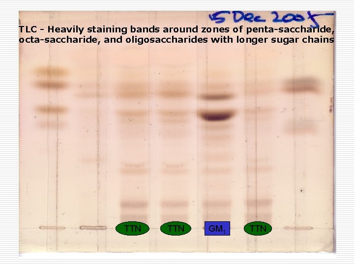 TLC - Heavily staining bands around zones of penta-saccharide, octa-saccharide, and oligosaccharides with longer