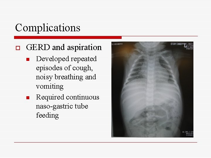 Complications o GERD and aspiration n n Developed repeated episodes of cough, noisy breathing