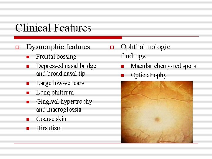 Clinical Features o Dysmorphic features n n n n Frontal bossing Depressed nasal bridge