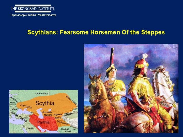 Laparoscopic Radical Prostatectomy Scythians: Fearsome Horsemen Of the Steppes 