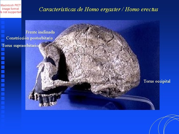 Características de Homo ergaster / Homo erectus Frente inclinada Constricción postorbitaria Torus supraorbitario Torus