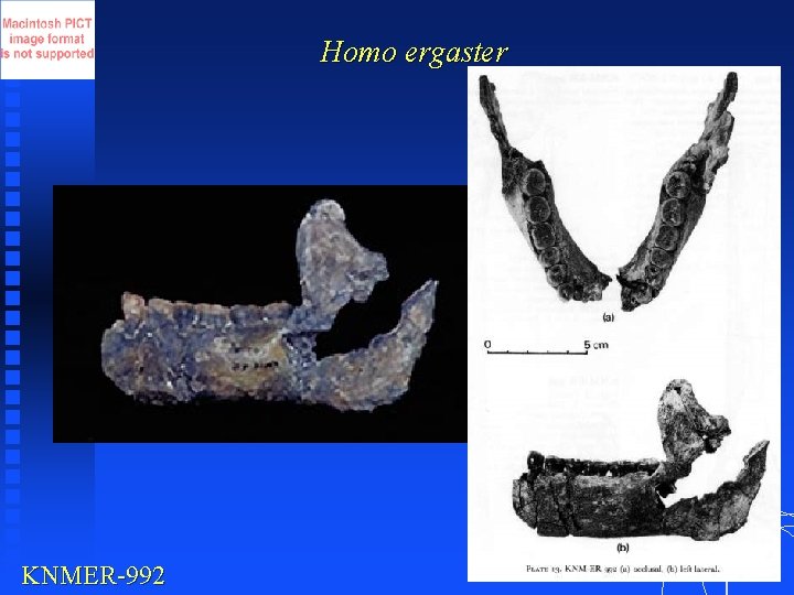 Homo ergaster KNMER-992 