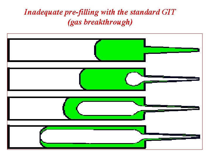 Inadequate pre-filling with the standard GIT (gas breakthrough) Inadequate pre-filling with the standard GIT (gas breakthrough)