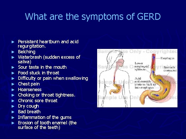 What are the symptoms of GERD ► ► ► ► Persistent heartburn and acid