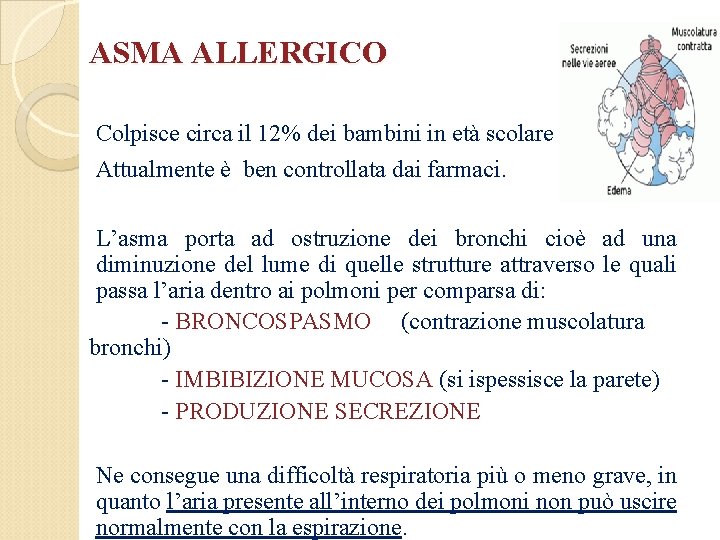 ASMA ALLERGICO Colpisce circa il 12% dei bambini in età scolare Attualmente è ben