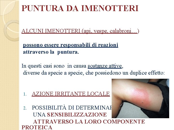 PUNTURA DA IMENOTTERI ALCUNI IMENOTTERI (api, vespe, calabroni…) possono essere responsabili di reazioni attraverso