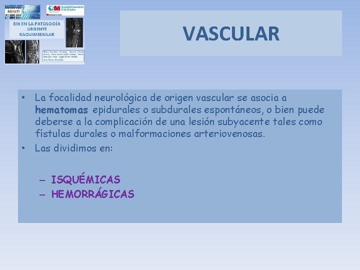VASCULAR • La focalidad neurológica de origen vascular se asocia a hematomas epidurales o