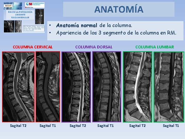 ANATOMÍA • Anatomía normal de la columna. • Apariencia de los 3 segmento de