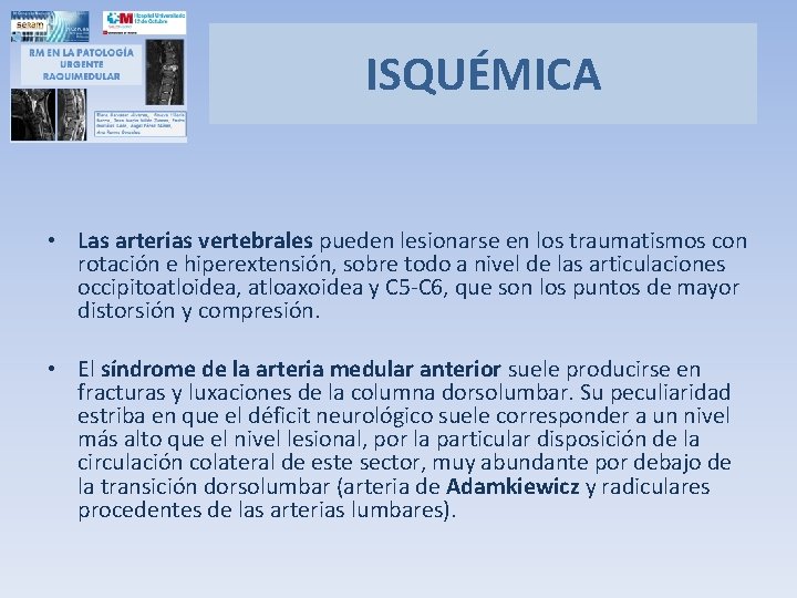 ISQUÉMICA • Las arterias vertebrales pueden lesionarse en los traumatismos con rotación e hiperextensión,