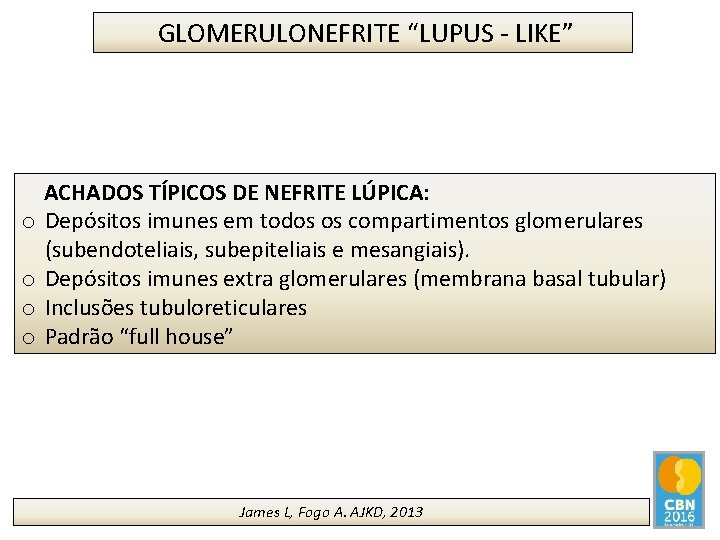 GLOMERULONEFRITE “LUPUS - LIKE” ACHADOS TÍPICOS DE NEFRITE LÚPICA: o Depósitos imunes em todos