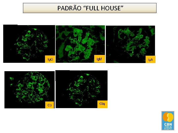 PADRÃO “FULL HOUSE” C 1 q 