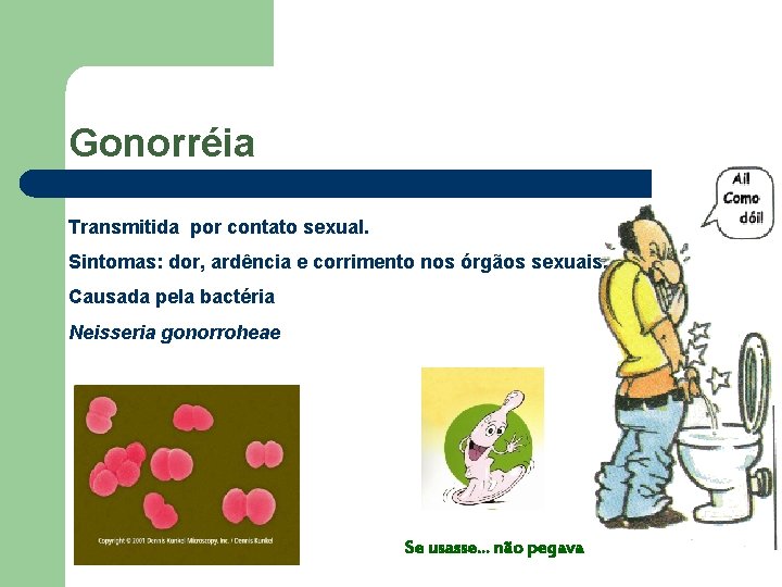 Gonorréia Transmitida por contato sexual. Sintomas: dor, ardência e corrimento nos órgãos sexuais. Causada